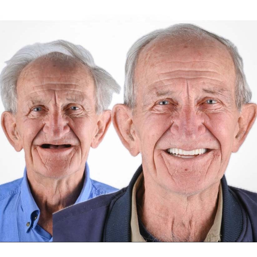 Removable Dentures with Flexible Cushion Grip Full Arch Set and Storage Case - Image 12