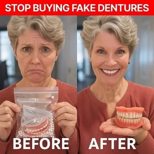 Removable Dentures with Flexible Cushion Grip Full Arch Set and Storage Case - Image 4