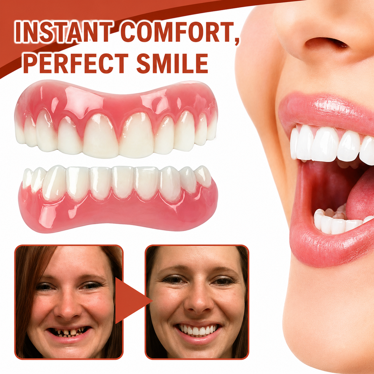 Snap on Veneers Temporary Fake Teeth with Moldable Fit Upper and Lower Set - Image 1