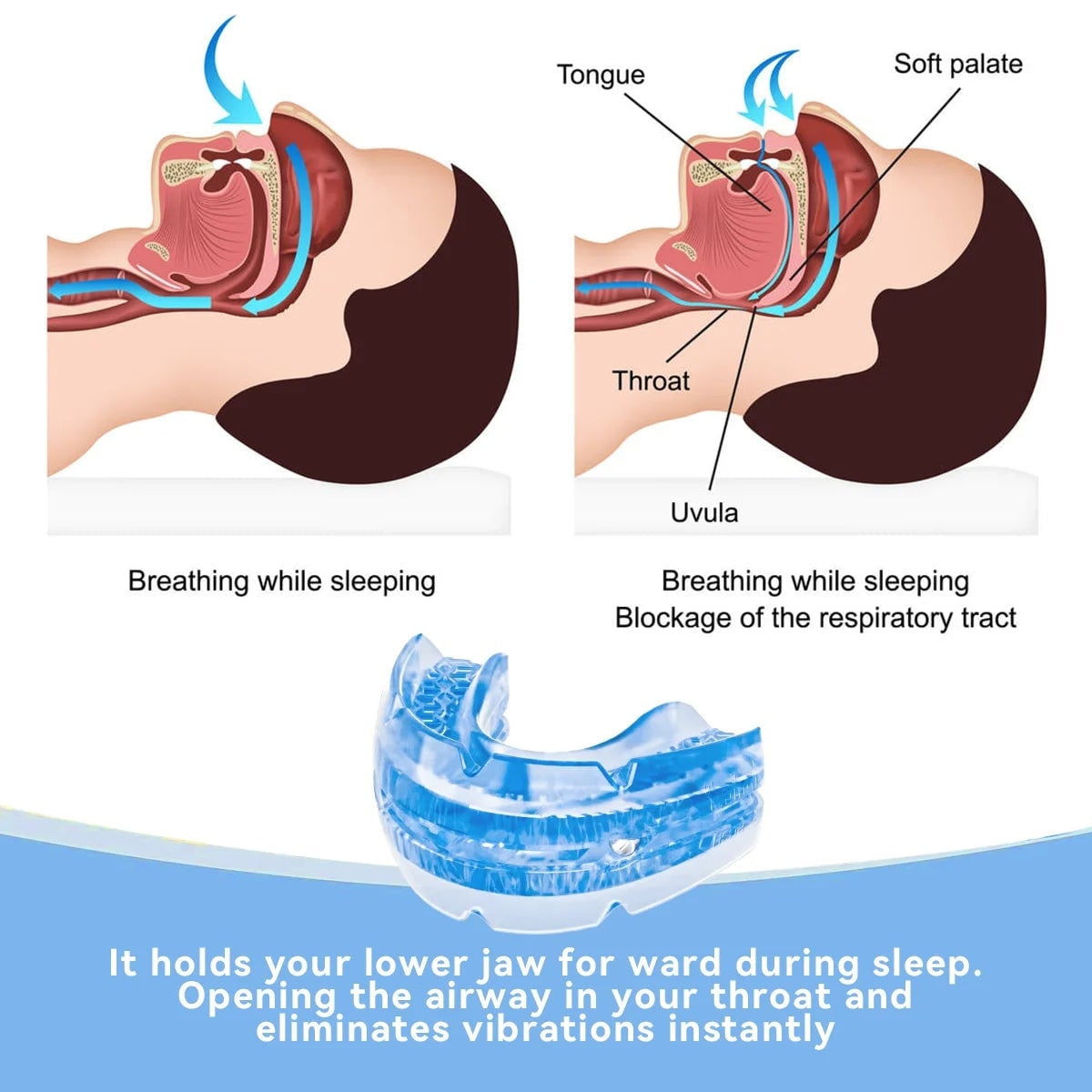 Snoring Mouth Guard with Adjustable Anti Mouthpiece Screwdriver and Storage Case - Image 3